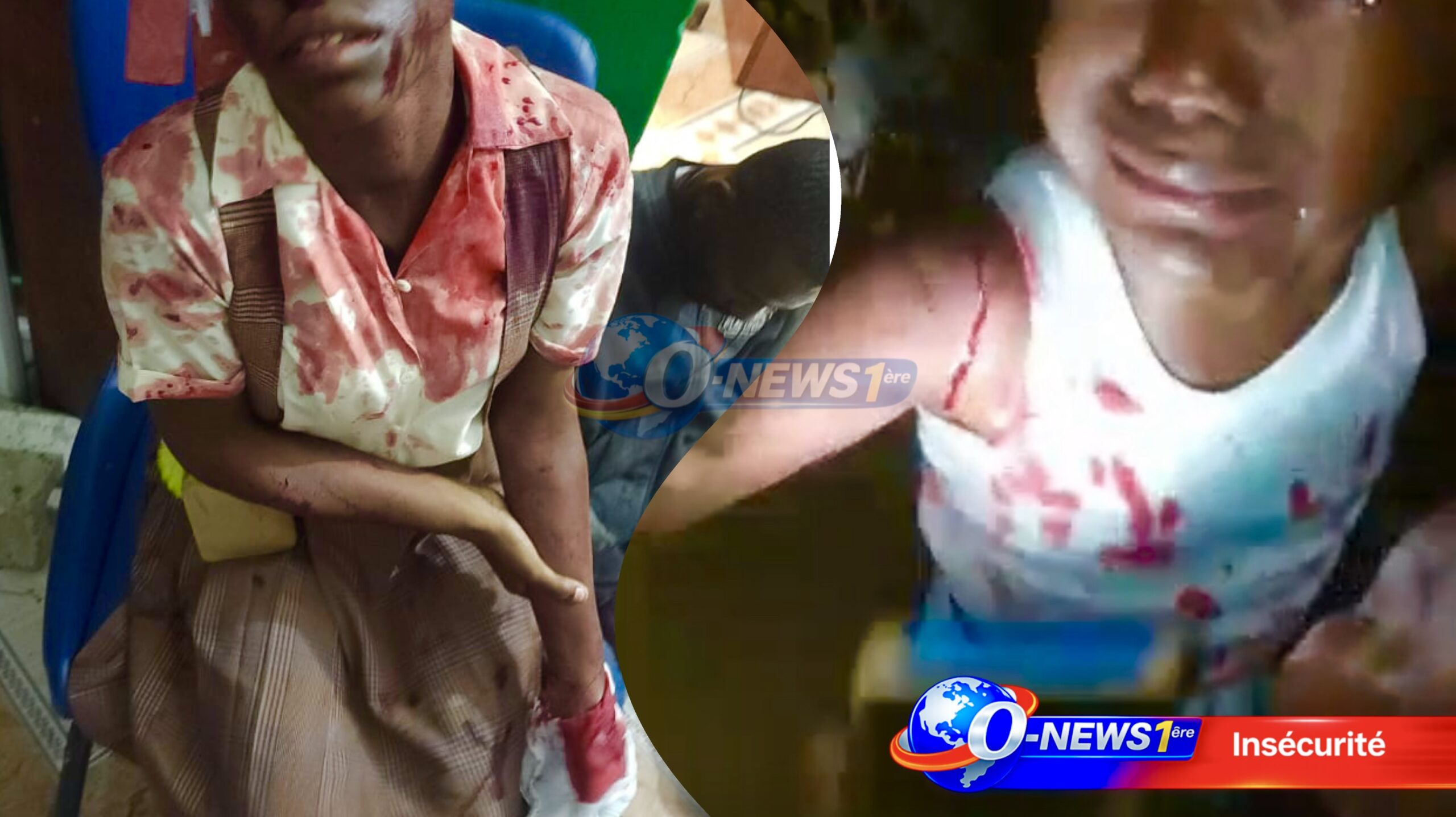 Martissant 2B ensanglanté : des enfants mutilés par des frappes de drones de la PNH